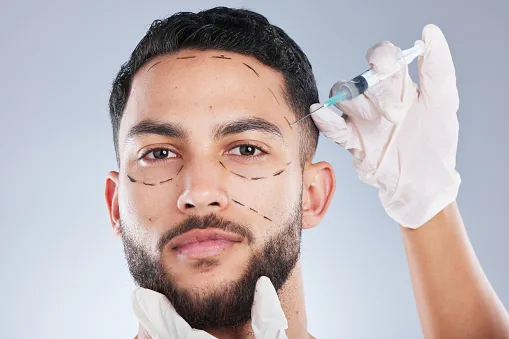 Injections du visage à l'acide hyaluronique