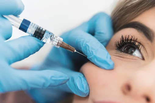 Injection d'acide hyaluronique du visage au Centre C.L.O.E à Calais