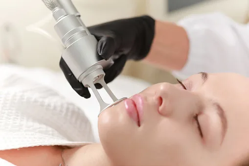 Lasers médicaux pour la peau