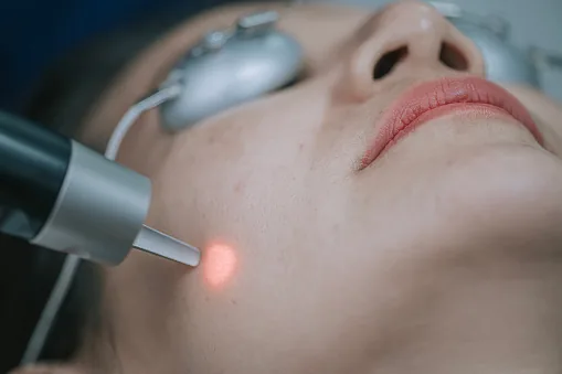 Laser médical esthétique au Centre C.L.O.E
